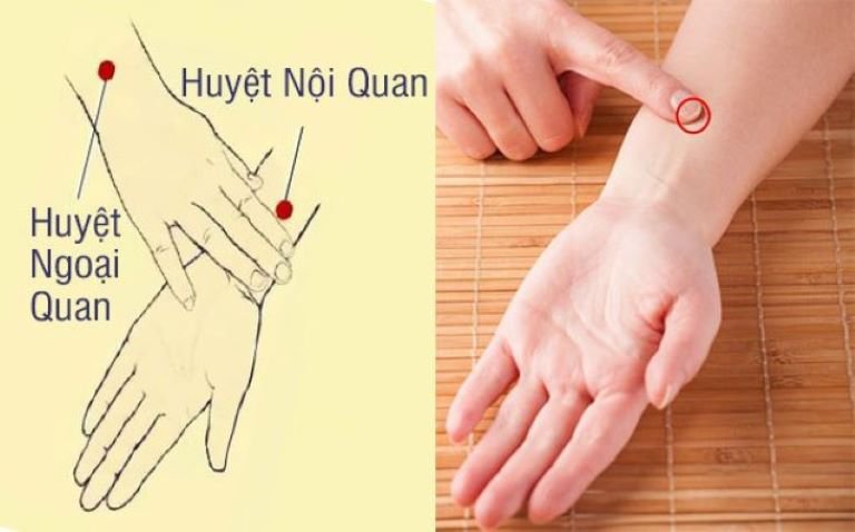 Bấm huyệt nội quan trị xuất tinh sớm